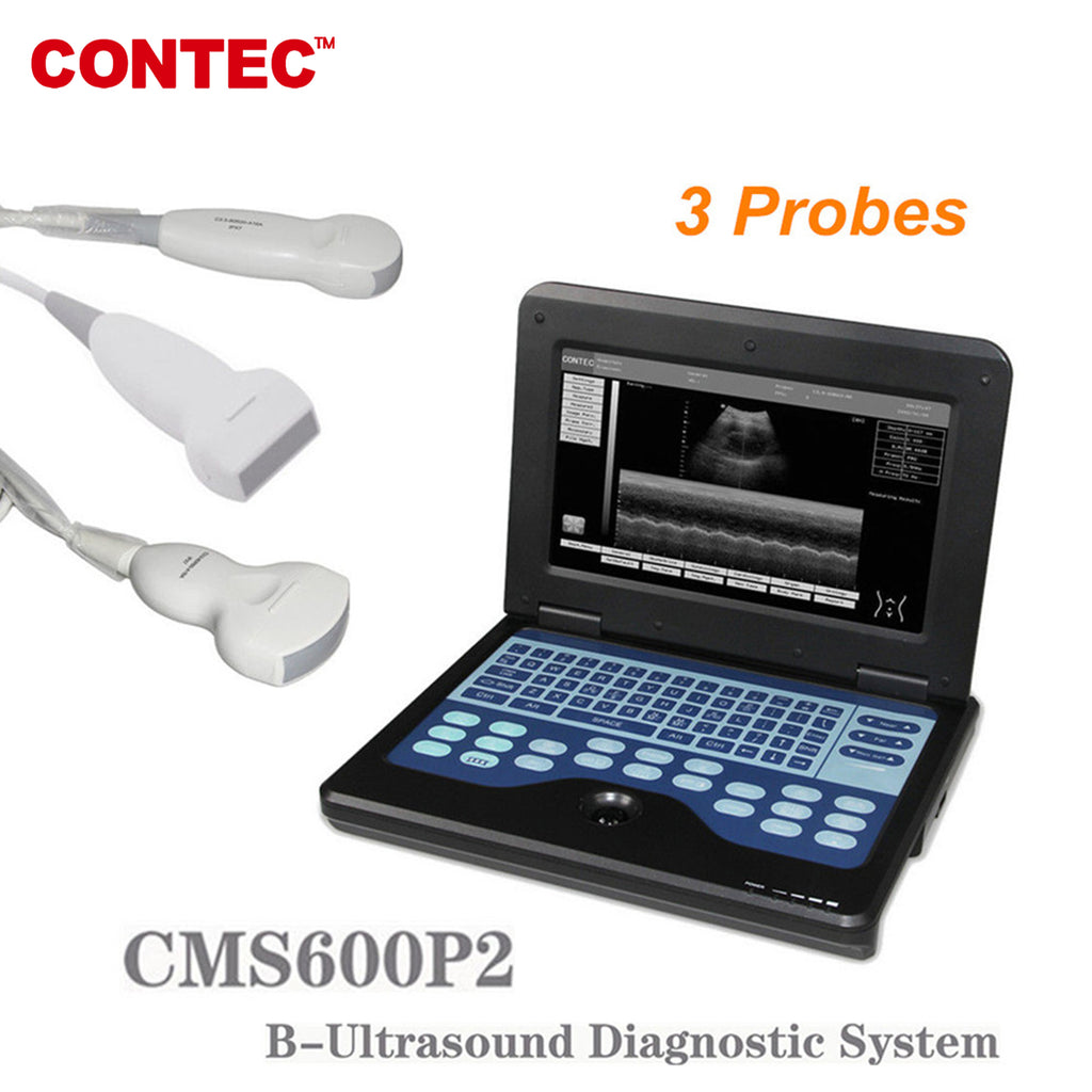 Portable Laptop Machine Digital Ultrasound Scanner, Convex+Linear+Cardiac 3 Probes - CONTEC
