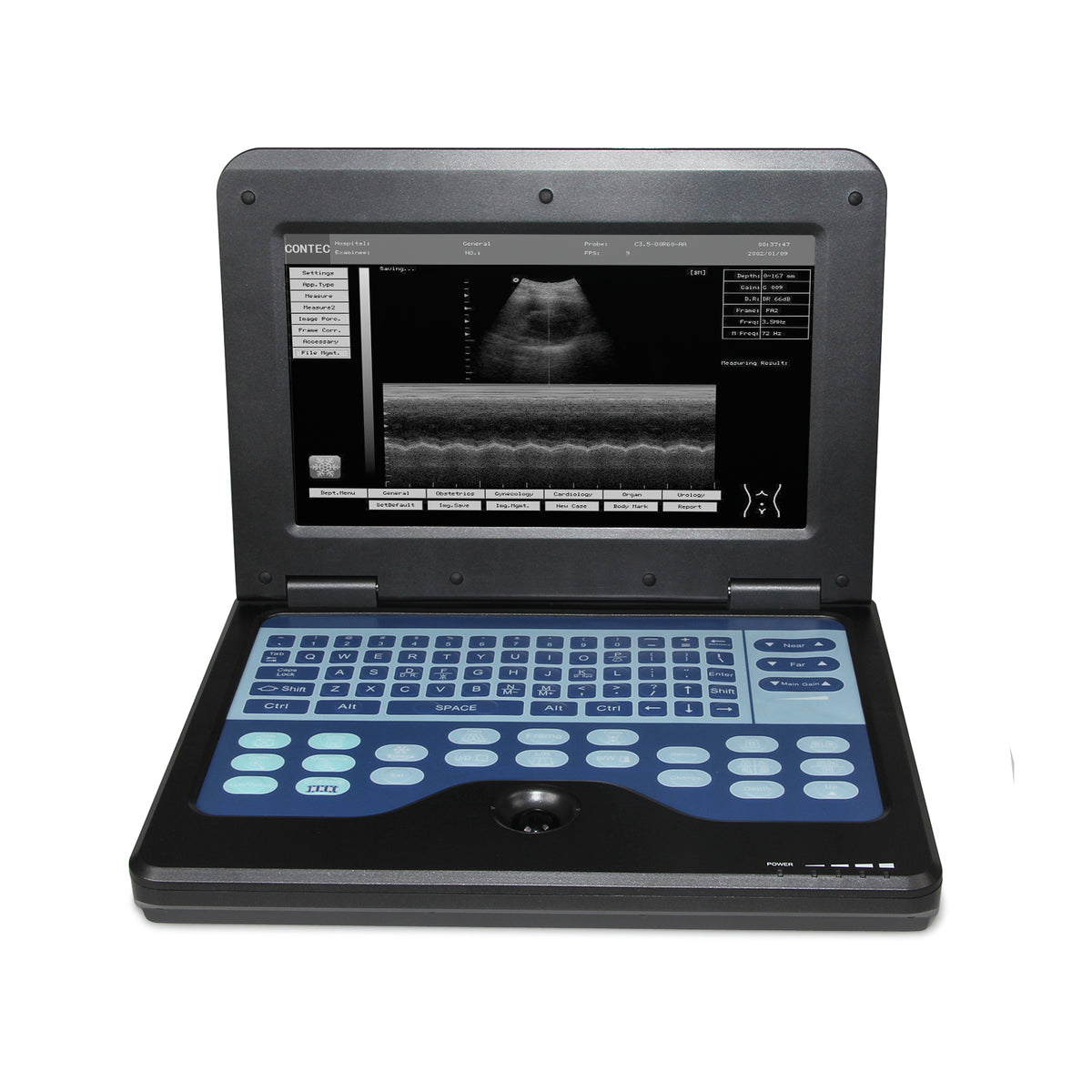 Scanner de machine à ultrasons pour ordinateur portable vétérinaire 3.5MHZ  sonde convexe VET/Animaux 