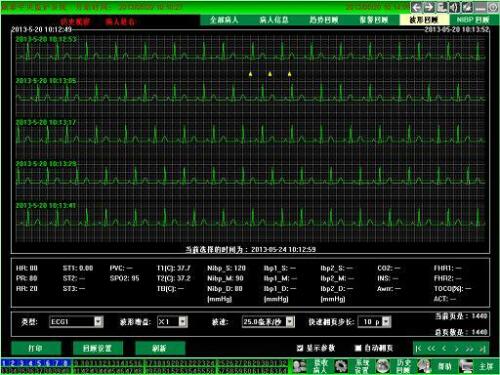 CONTEC CMS9000 Central Monitoring System,Networked to CONTEC Patient Monitor - CONTEC