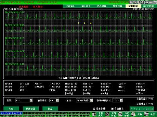 Shipping from China CMS9200plus CO2 Patient Monitor Vital Signs Monito –  CONTEC