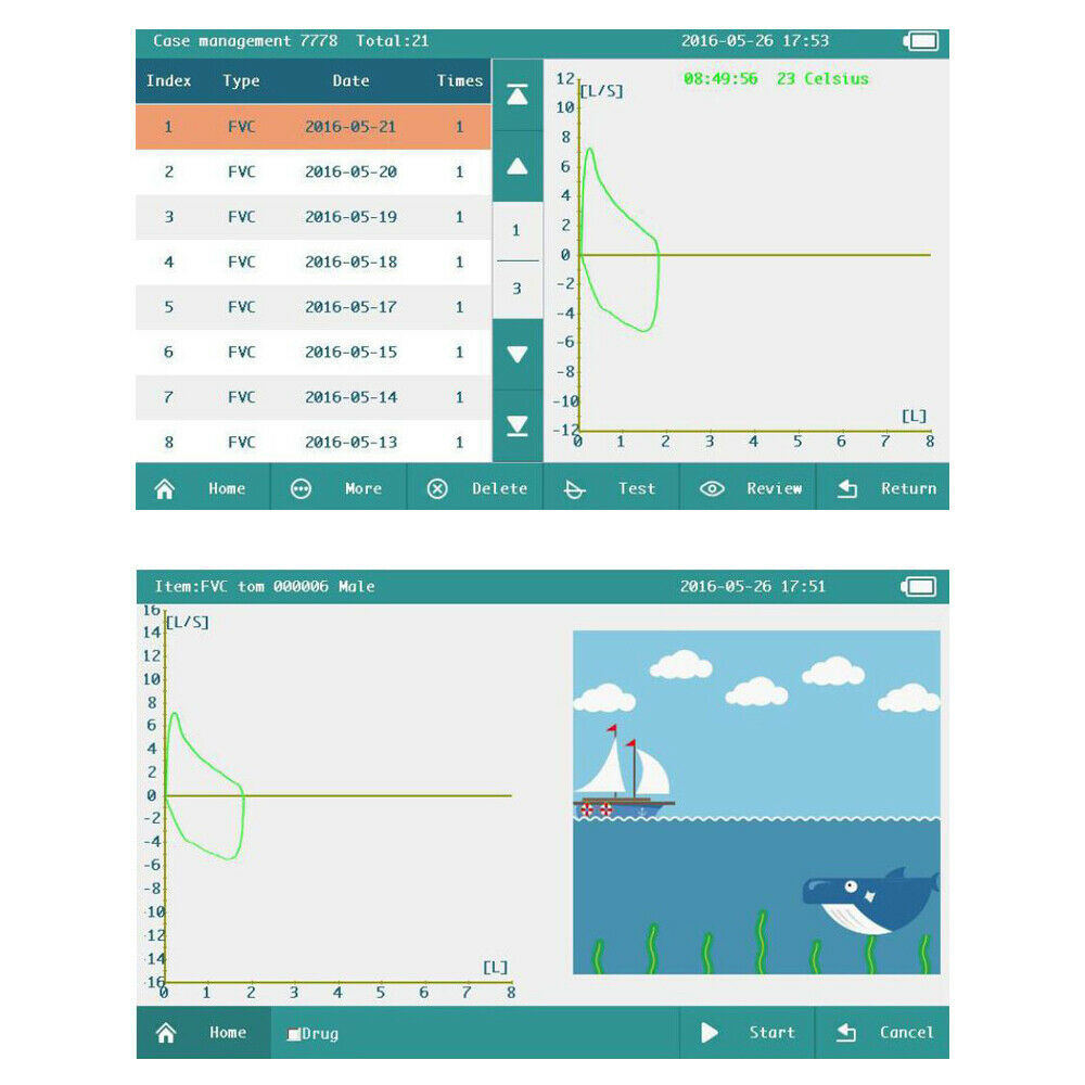 Portable lung function testing device Spirometer/Spirometry color LCD display - CONTEC