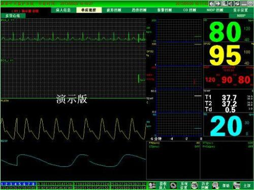 CONTEC CMS9000 Central Monitoring System,Networked to CONTEC Patient Monitor - CONTEC