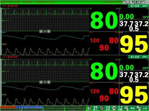 CONTEC CMS9000 Central Monitoring System,Networked to CONTEC Patient Monitor - CONTEC