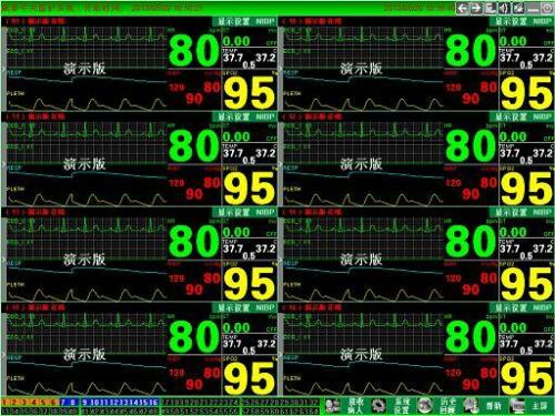 CONTEC CMS9000 Central Monitoring System,Networked to CONTEC Patient Monitor - CONTEC