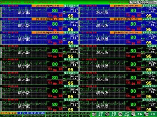 CONTEC CMS9000 Central Monitoring System,Networked to CONTEC Patient Monitor - CONTEC