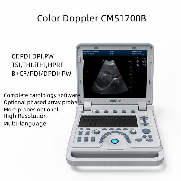 Scanner à ultrasons couleur Portable CMS1700B, système de Diagnostic de cardiologie, Doppler couleur avec sonde