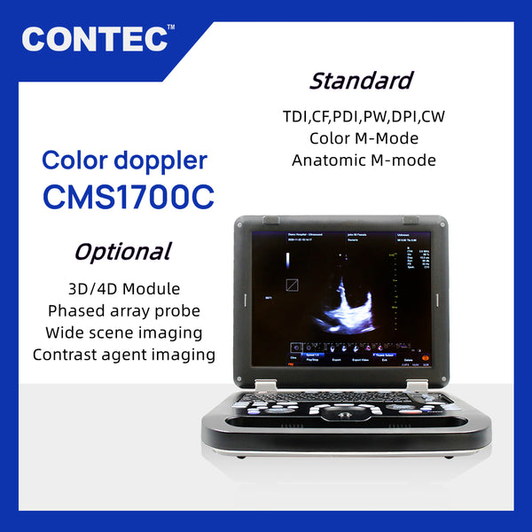 Scanner à ultrasons Portable Doppler couleur humain avec sonde CMS1700C, livraison depuis la chine