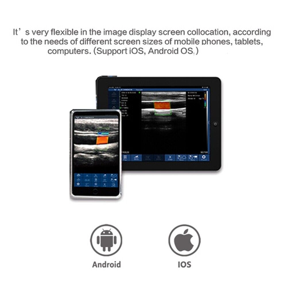 Scanner à ultrasons couleur Portable CMS1700B-VET, système de Diagnostic,  Doppler couleur avec sonde, pour animaux à usage vétérinaire