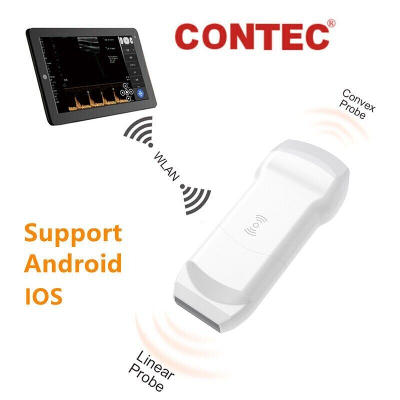 CONTEC CMS1600A Color Doppler Ultrasound Scanner Wifi Machine Software