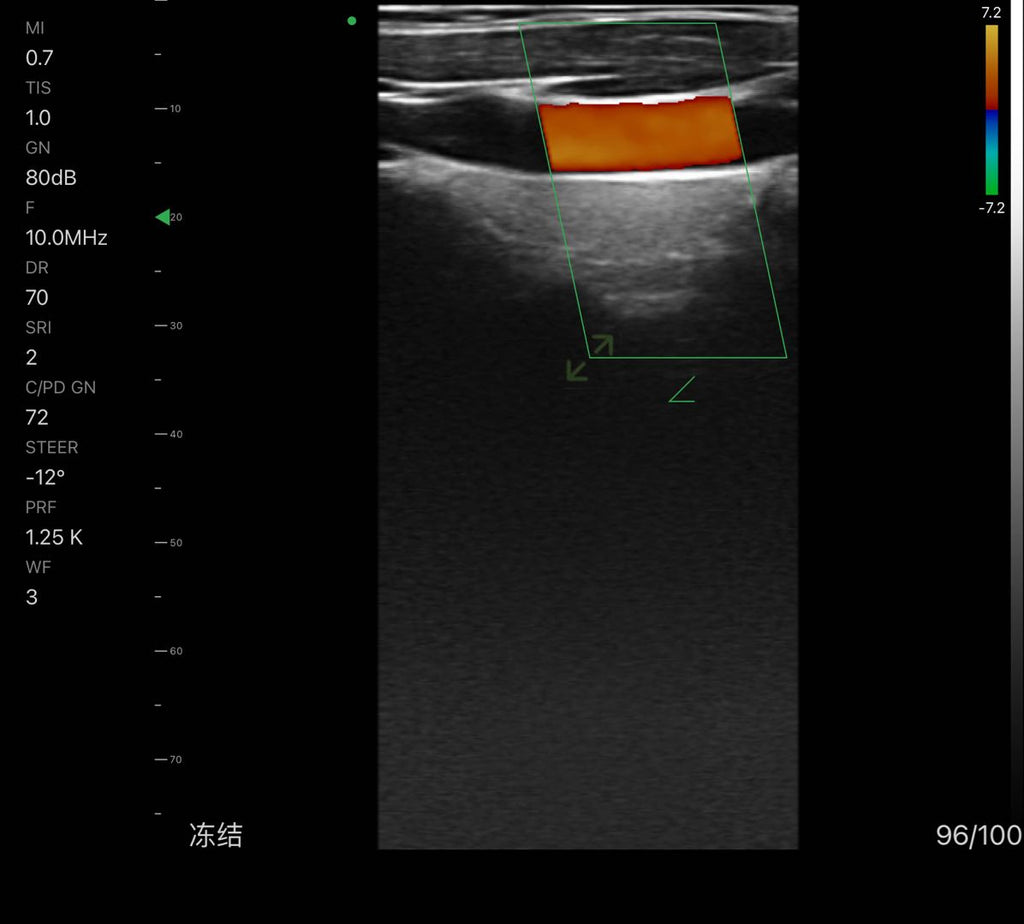 CMS1600A Color Doppler Ultrasound Scanner Wifi Wireless Machine Softwa –  ContecEurope