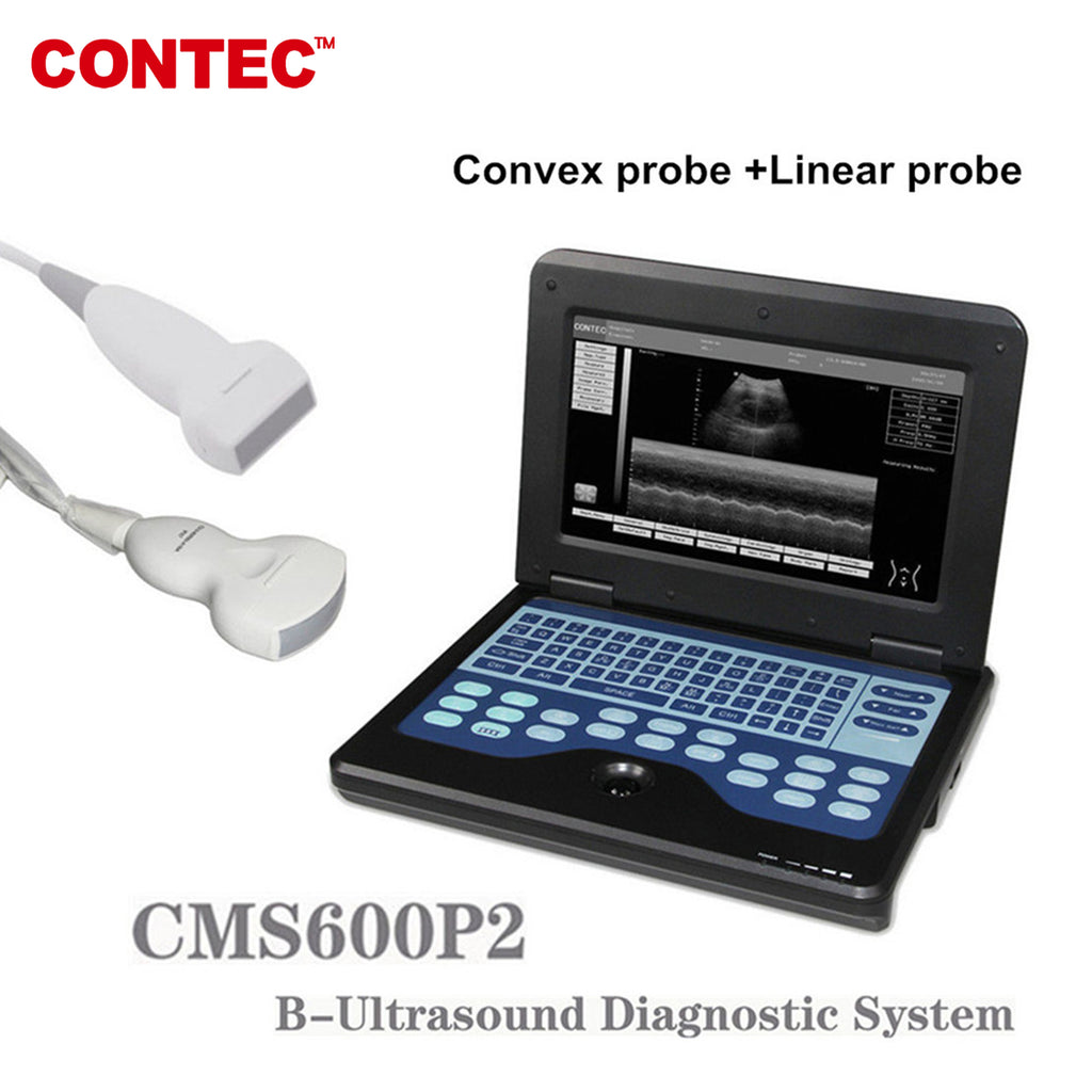 Portable Laptop Machine Digital Ultrasound Scanner,7.5M Linear+3.5M Convex Probe - CONTEC