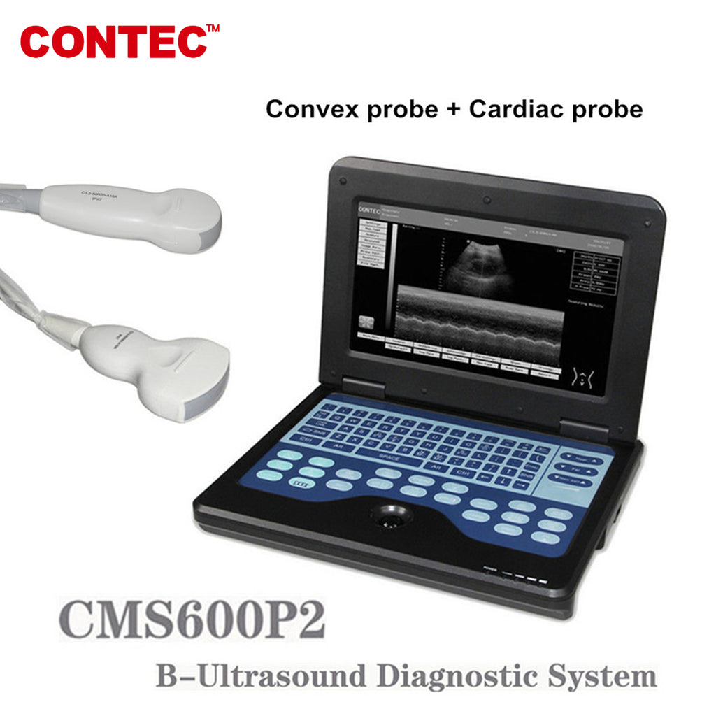 Portable Laptop Machine Digital Ultrasound Scanner,3.5M Cardiac Probe+3.5M Convex Probe - CONTEC