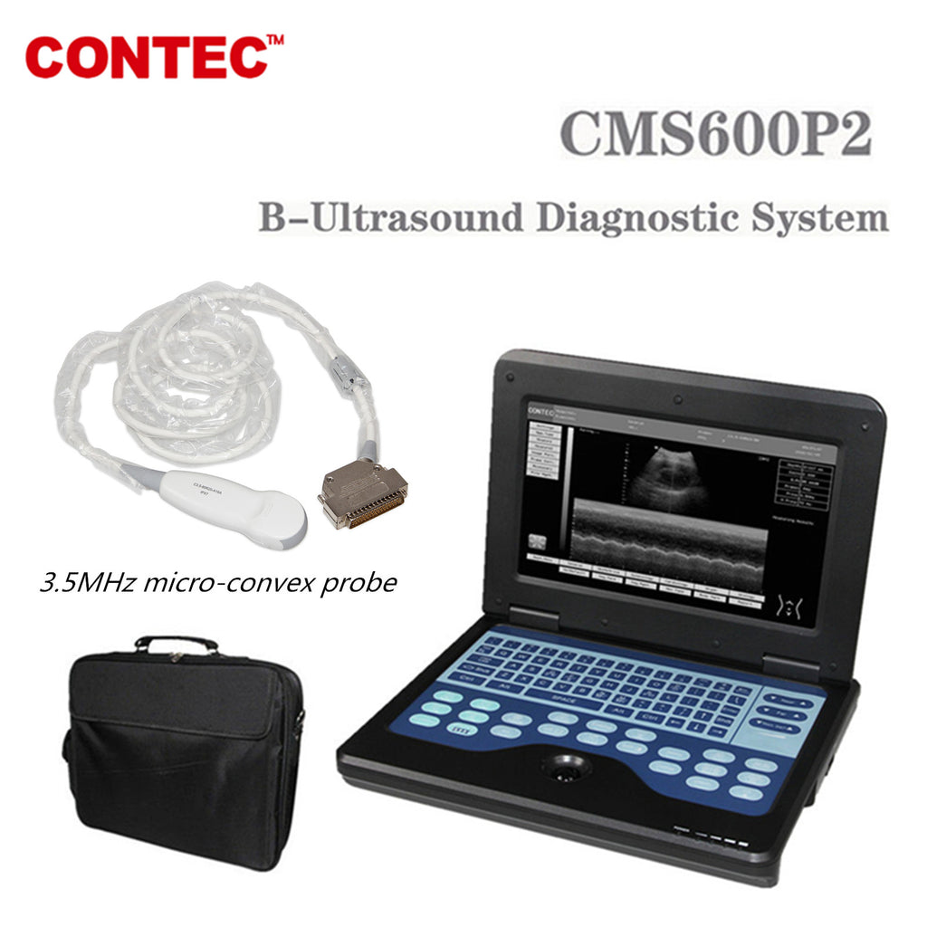 CONTEC Portable Laptop Machine Digital Ultrasound Scanner,3.5MHz micro-convex Probe CMS600P2 - CONTEC