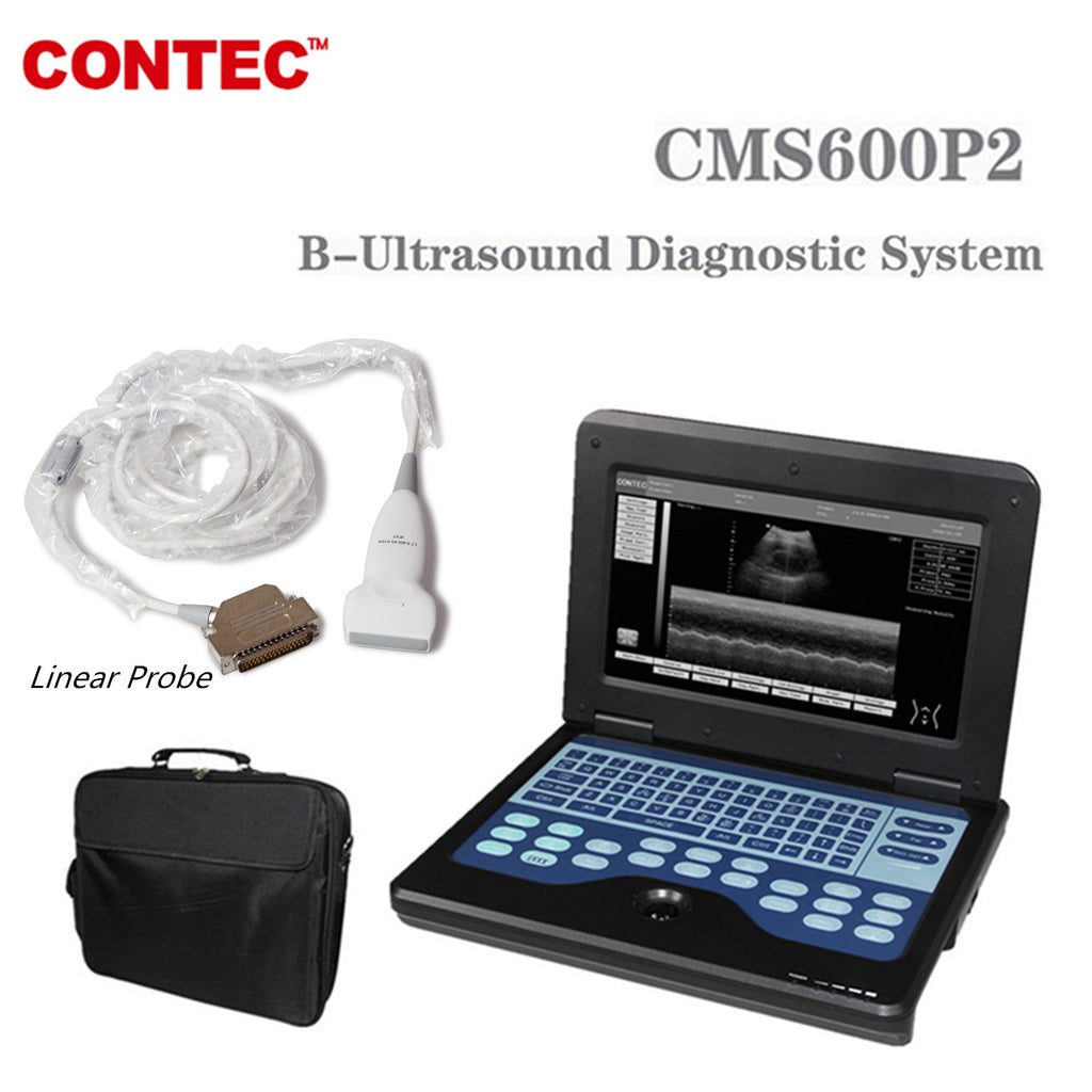 CONTEC Portable Laptop Machine Digital Ultrasound Scanner,7.5 MHZ Linear Probe CMS600P2 - CONTEC