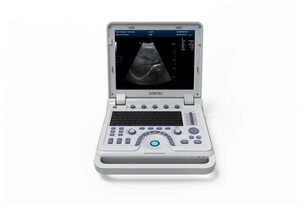 CONTEC CMS600P2PLUS B-scanner à ultrasons nouvelle machine toutes sortes de sondes en option