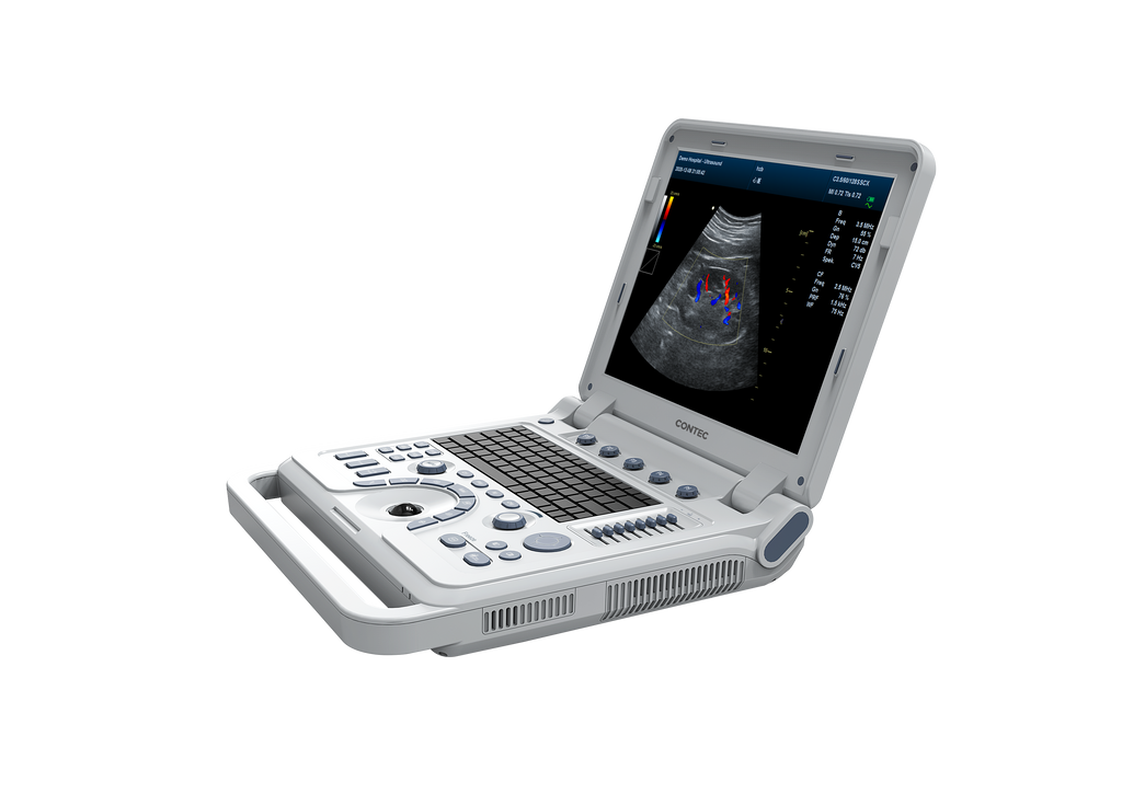 Scanner à ultrasons couleur Portable CMS1700B, système de