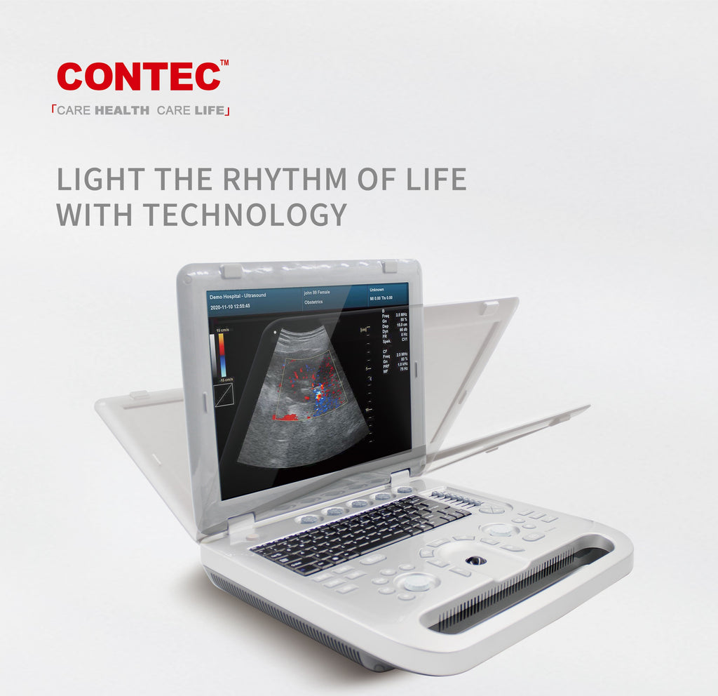 CONTEC CMS1700A Portable Color Doppler Ultrasound Scanner Machine+ Probe
