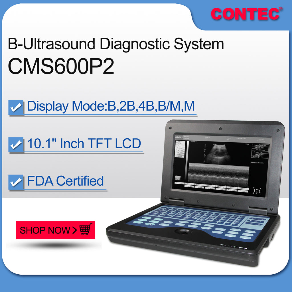 CONTEC Portable Laptop Machine Digital Ultrasound Scanner,3.5 Convex Probe CMS600P2 - CONTEC