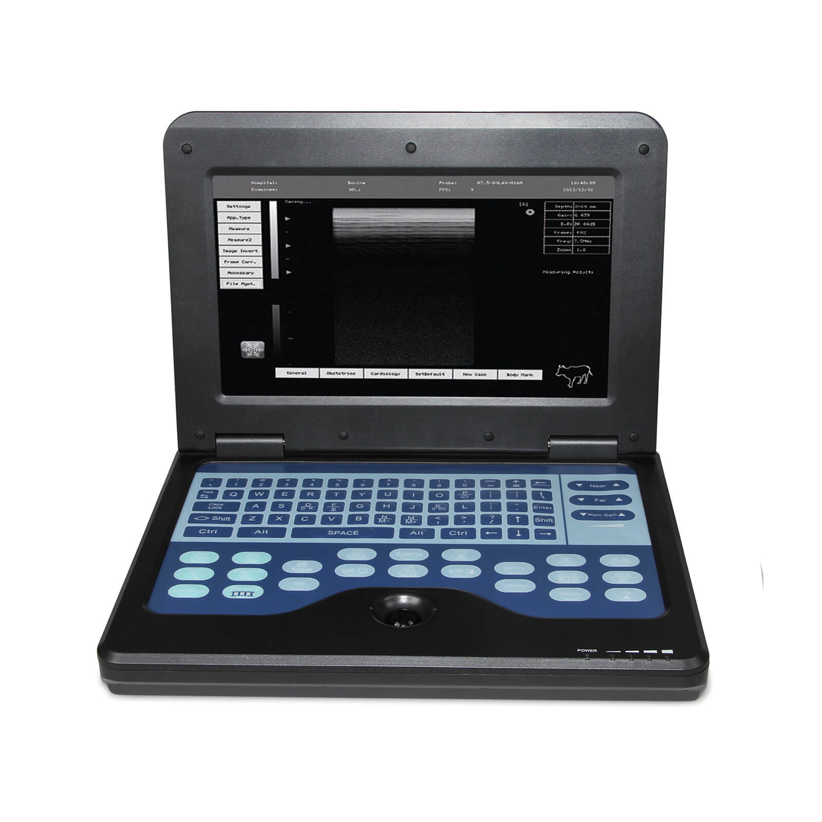 Échographe Vétérinaire Portable CMS600P2VET - Écran LCD, Sonde Convexe 3.5MHz, Marque CON-TEC