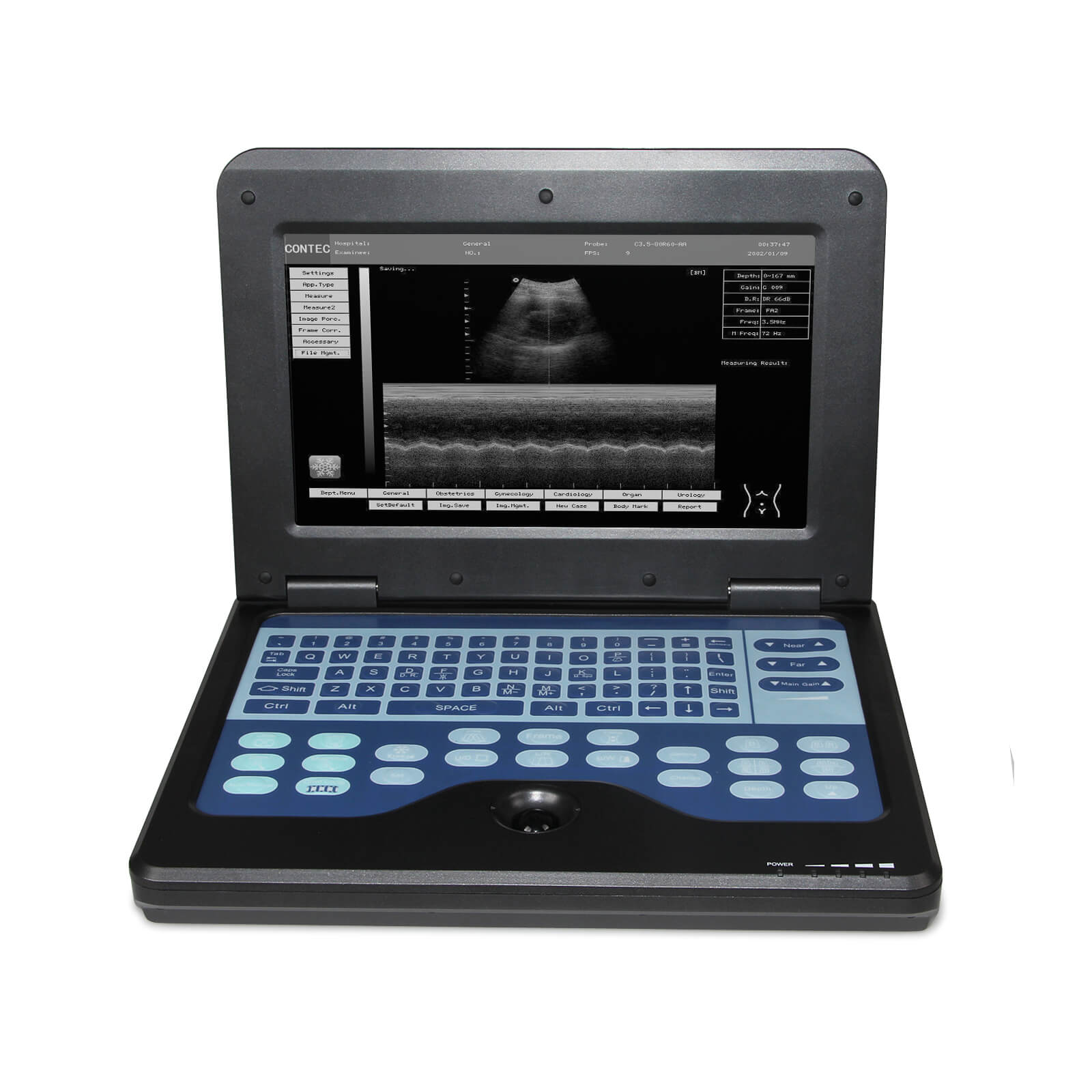CMS600P2 Portable Laptop Machine Digital Ultrasound Scanner,7.5M Linea ...