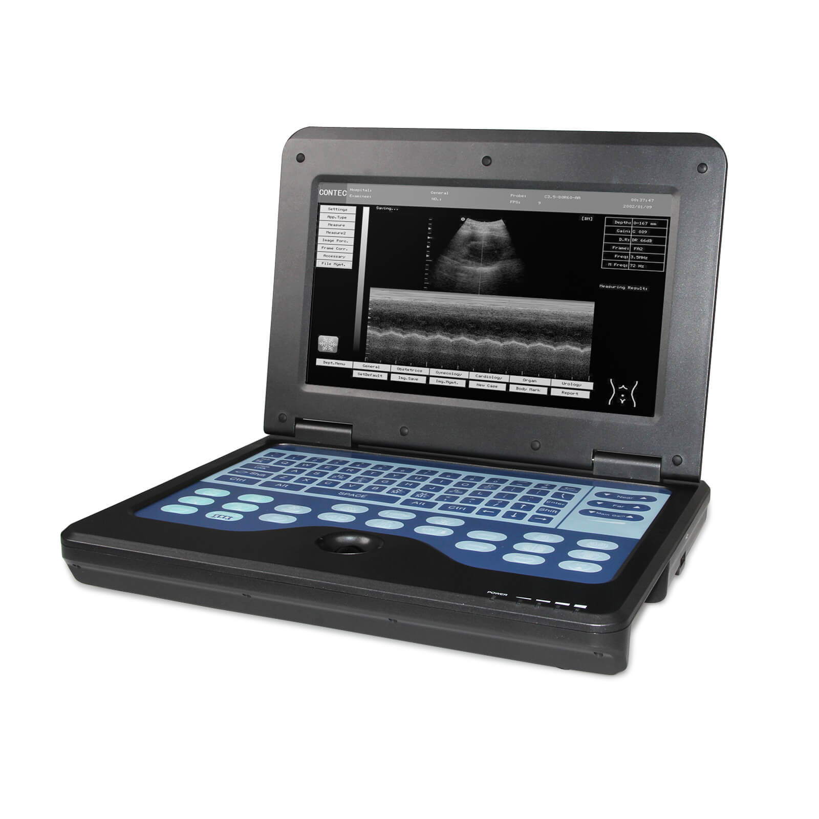 CMS600P2 Portable Laptop Machine Digital Ultrasound Scanner,7.5M Linea ...