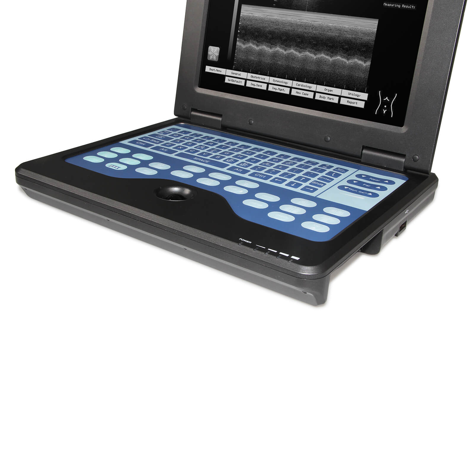 CMS600P2 Portable Laptop Machine Digital Ultrasound Scanner,7.5M Linea ...