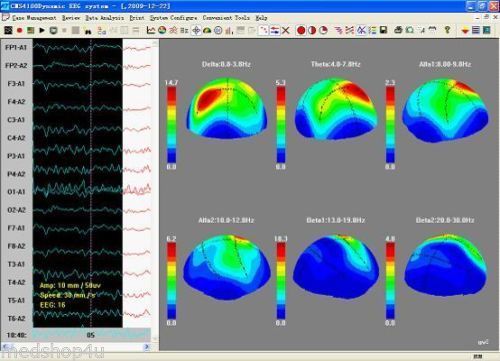 Contec CMS4100 24H Dynamic EEG Machine 16 Channel EEG Holter SD Card P ...